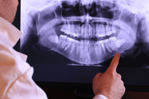 Best Emergency Treatment for Toothache in Spring Grove, IL